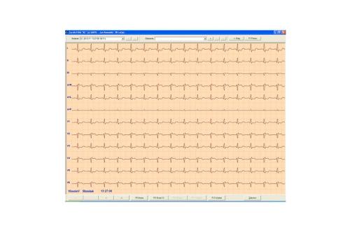 Λογισμικό Καρδιογράφων Aspel CardioTEKA