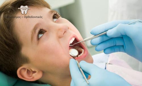 Sealants οπισθίων δοντιών, μια καινούργια μέθοδο πρόληψης ενάντια στην τερηδόνα, γρήγορη και ανώδυνη ειδικά για μικρά παιδιά με κάλυψη οπών και σχισμών